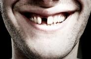 Что означают зубы в сновидениях и как растолковать по сонникам значения